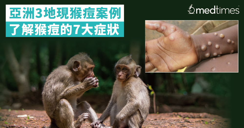 【疫症未平】亞洲三地現猴痘案例！了解猴痘的7大症狀